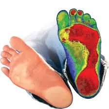 3D foot scan image showing pressure points